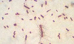 Wet Mount Motility Test